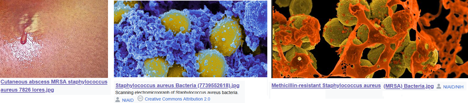 PEMF Staph aureus atopic dermatitis