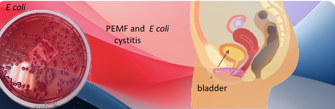 PEMF bladder infection
