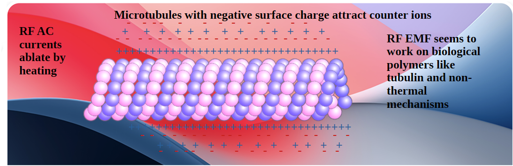 Radio frequency ablation